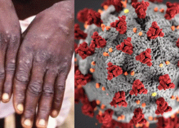 Сармагчны цэцэг өвчлөлийн талаар ДЭМБ-аас гаргасан зөвлөмж