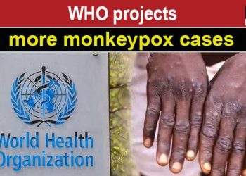 ДЭМБ: Сармагчны цэцэг өвчний эсрэг нийтийн вакцинжуулалт хийх шаардлагагүй